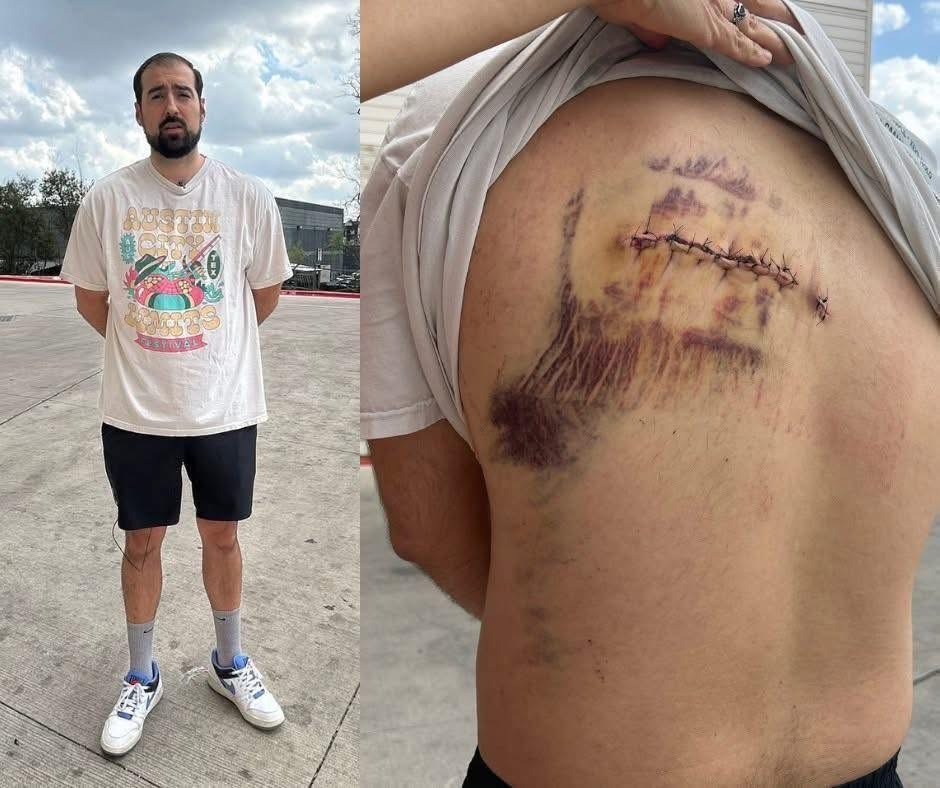 Austin Bar Shooting Survivor George Davis Speaks Through Recovery: Community Prays for His Healing.