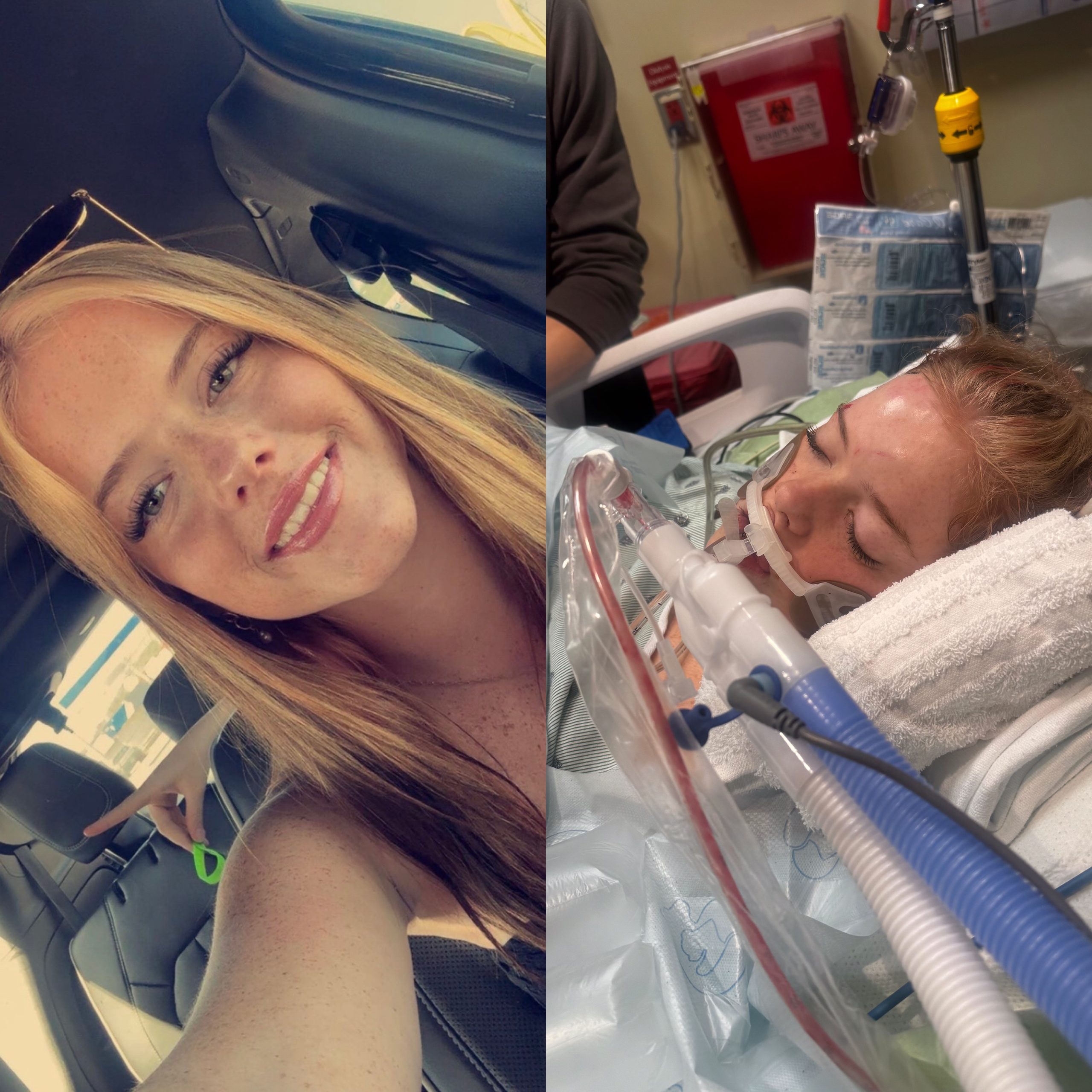 Cullman Woman Fights for Life After Devastating Car Accident: Community Rallies Around Dilynn Turner Following Serious Injuries.